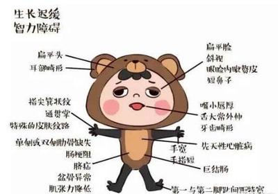 胎儿头小会影响智力吗