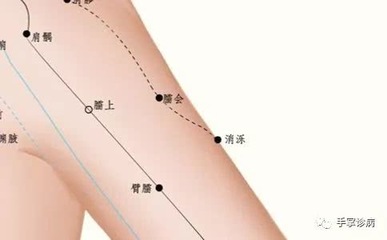 月经期间膝盖疼是怎么回事