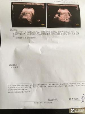 怀孕47天没有胎心胎芽正常吗