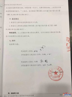 肋骨骨折司法鉴定标准