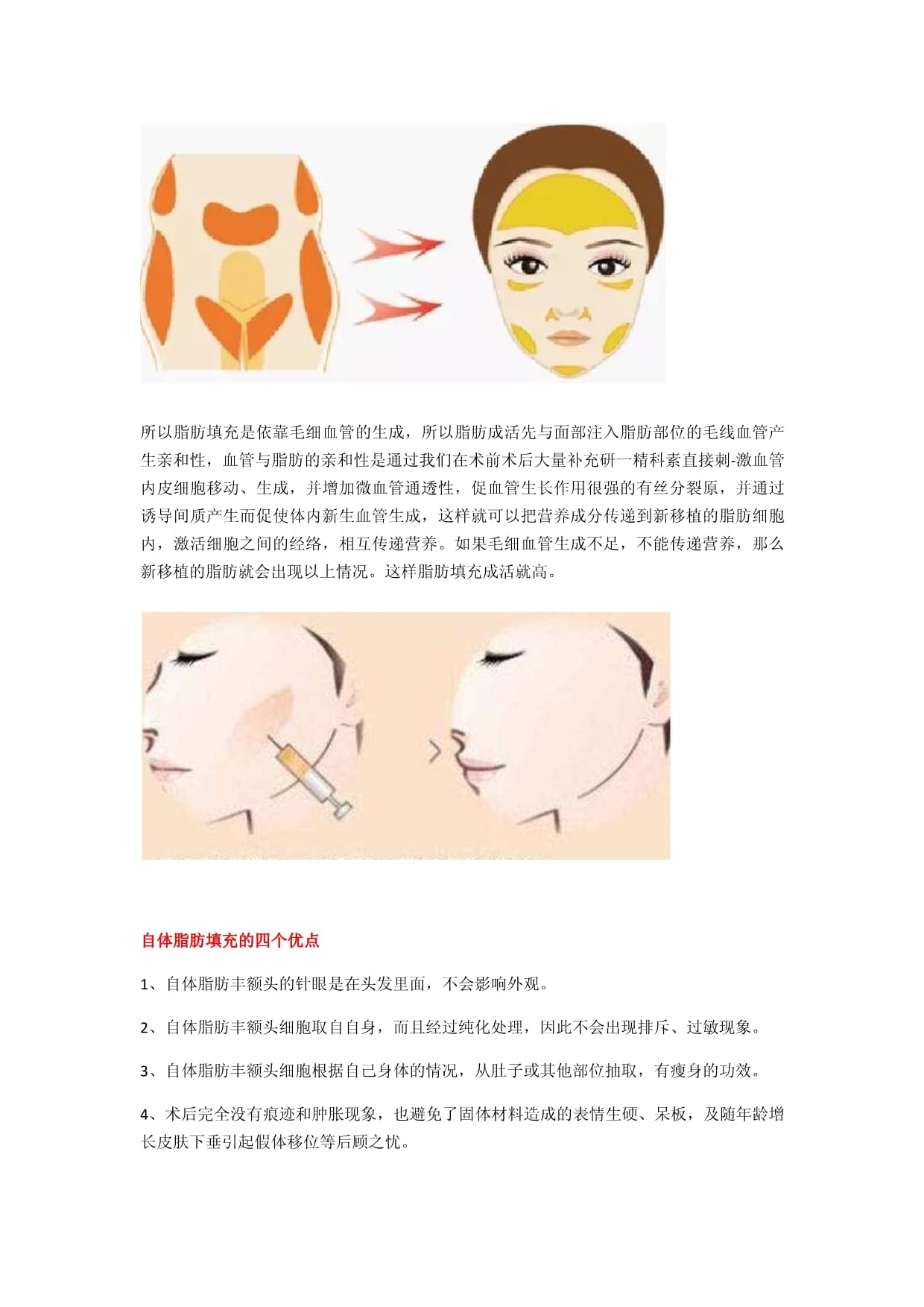 脸部填充脂肪的副作用