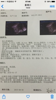 怀孕6个月做什么检查