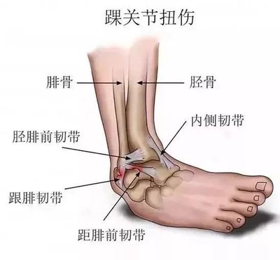 腓骨痛是怎么回事