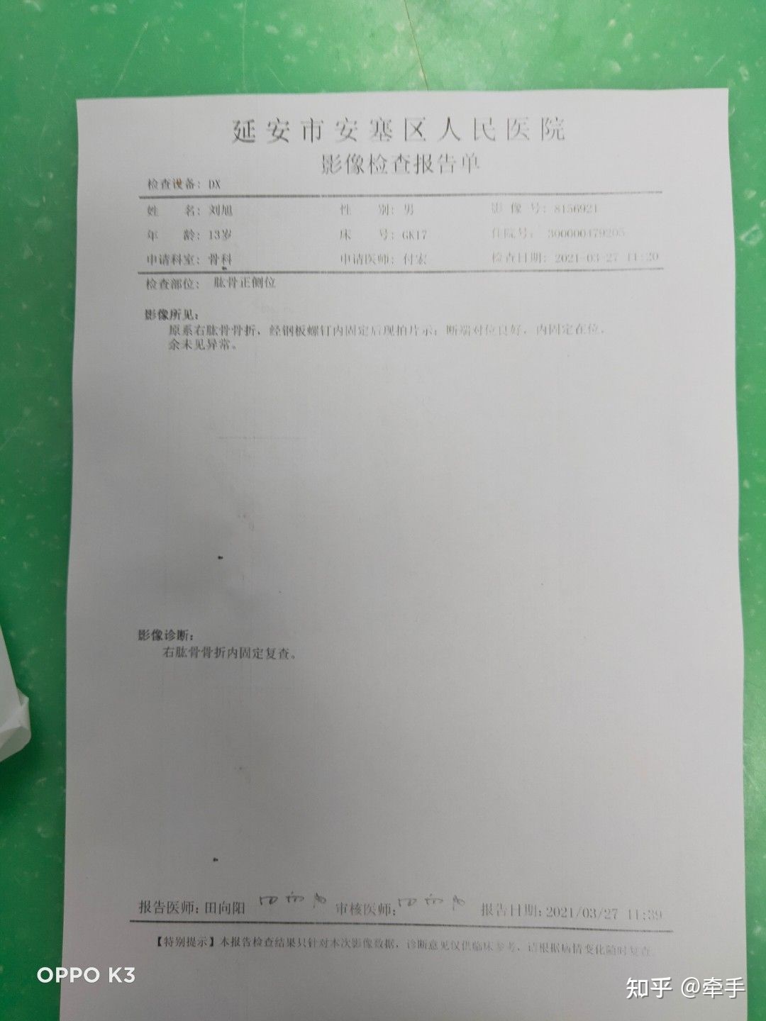 肱骨骨折算几级伤残