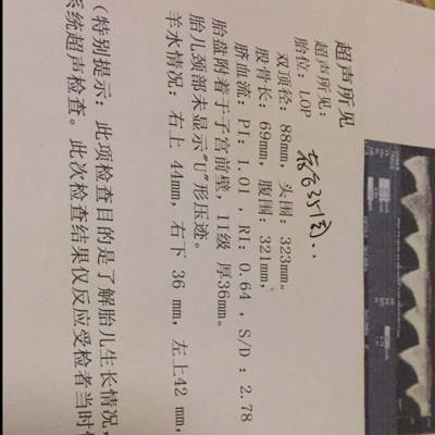 下巴长痦子的女人面相