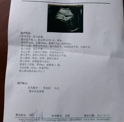 胎儿头位是入盆了吗