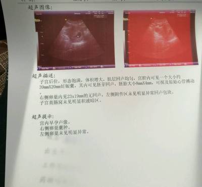 怎么测试男女宝宝最准