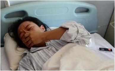 怀孕几天怎么打掉孩子