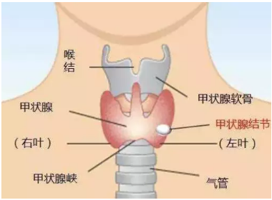 有多少人有甲状腺节结