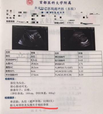 北京产检 价格多少钱
