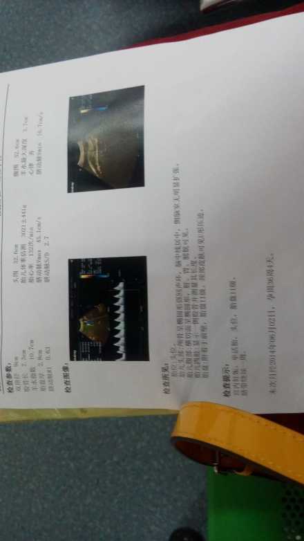 孕36周后胎儿一周一般能长重