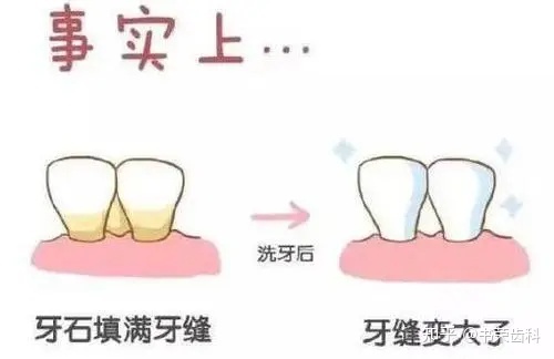 牙缝疼是怎么回事