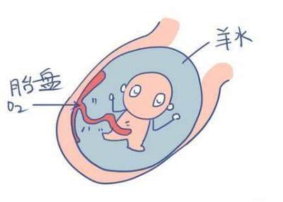 为什么胎儿会缺氧