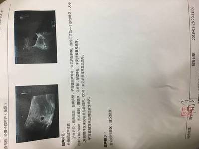 怀孕五周肚子疼是怎么回事