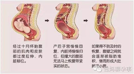 产后肚子很大怎么办