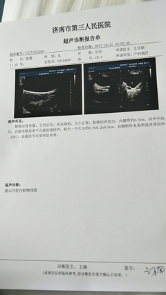 怀孕12周能做人流吗