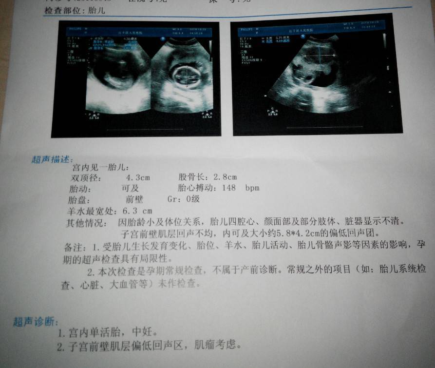 怀孕18周胎儿稳定了吗
