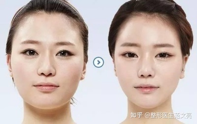 瘦脸针为什么会凹陷