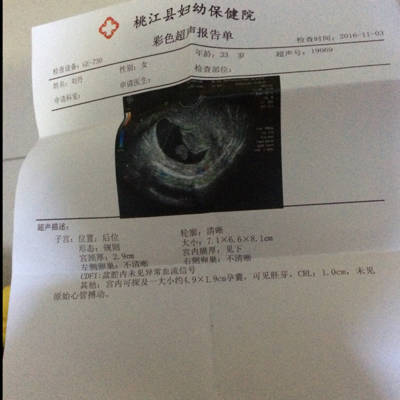 怀孕三个月见红了怎么办