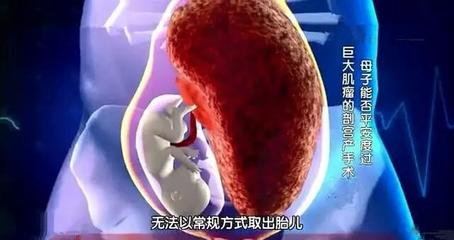 5个月胎儿一直动个不停