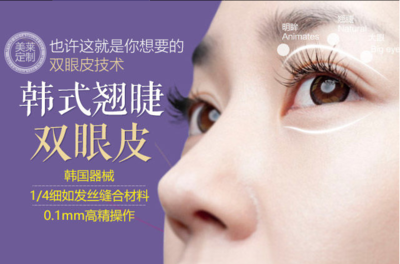 割双眼皮首选蕾帝整形