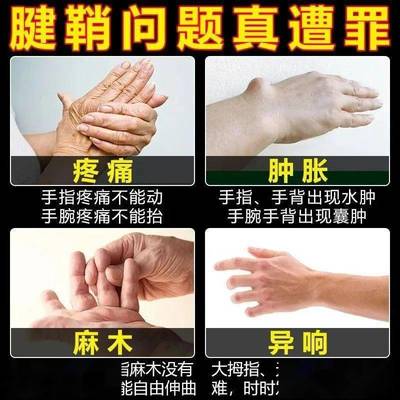 手背麻木是怎么回事