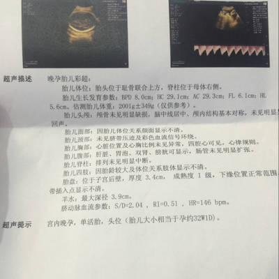 33周宝宝4斤正常吗