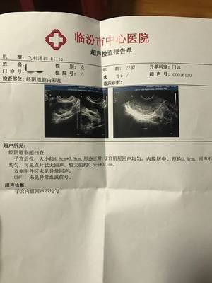 做完人流半个月来月经