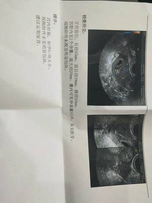 刚好30天能测出怀孕吗