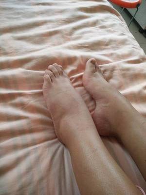 脚心难受是怎么回事
