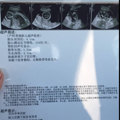 二十周的胎儿有多大