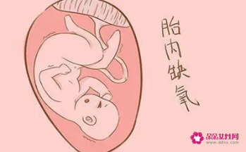 胎儿宫内缺氧的后果
