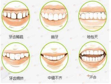 矫正牙齿的利与弊