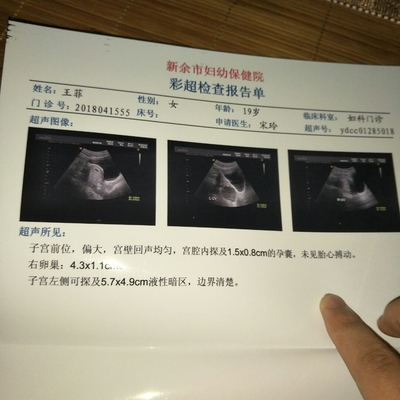 霉菌会影响胎儿吗