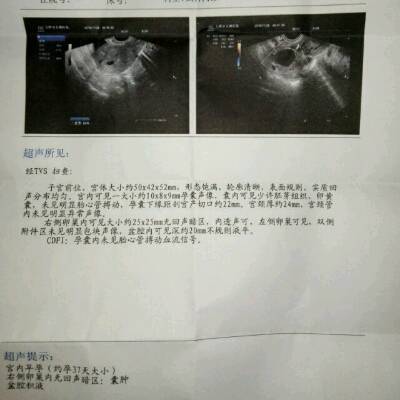 怀孕七个月能打胎吗