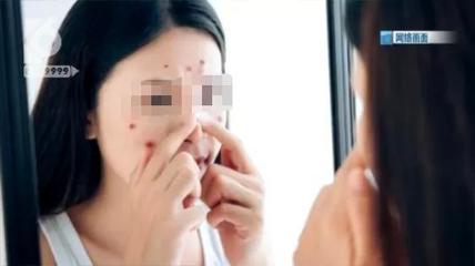 宁波看痘痘哪里最好