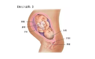 胎儿入盆的症状