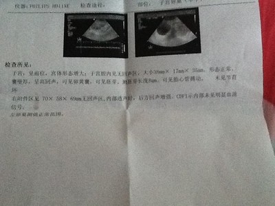 怀孕着床晚是什么意思