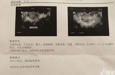 怀孕几周可以看到胎心胎芽