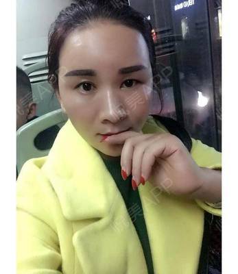 怎么形容疤痕