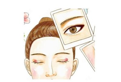 贴双眼皮睡觉