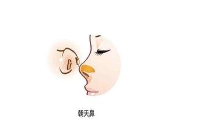 男人朝天鼻命运