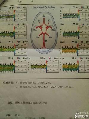 正常的脑血流速度是多少