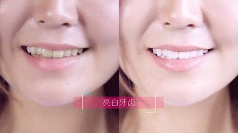 吸烟牙黄洗牙能变白吗