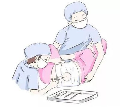 孕妇可以要求剖腹产吗