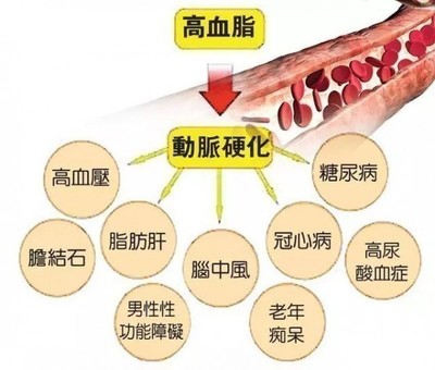 血脂高多少为高指血症