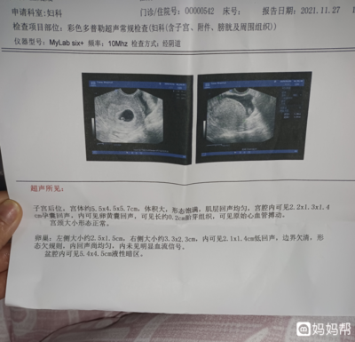 怀孕几个月能看出来男女