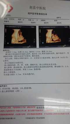 怀孕36周脐带绕颈两周怎么办