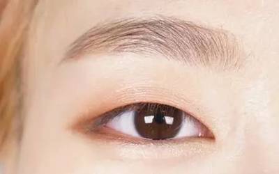 单眼皮有卧蚕吗