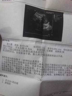怀孕36周脐带绕颈两周怎么办